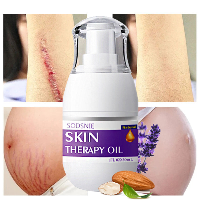 Skin Treatment Oil Remove Puncture Cellulite Stretch Mark Repair Body Care 30ml Skin Treatment Oil Remove Puncture Cellulite Stretch Mark Repair Body Care 30ml